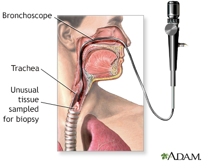 Upper airway test