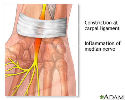 Indications