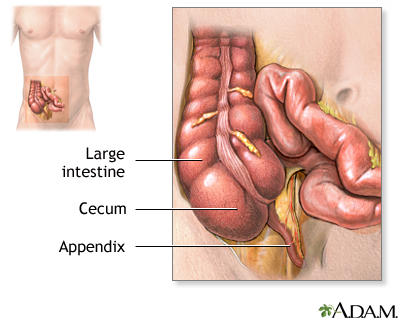 Appendix