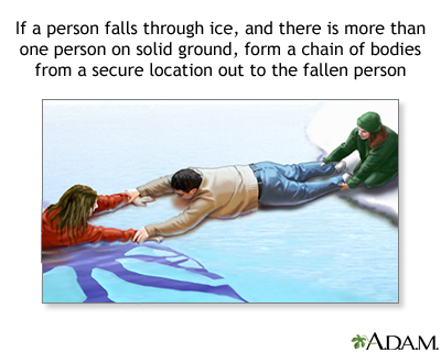 Drowning rescue on the ice, human chain