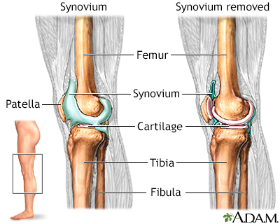 Knee joint