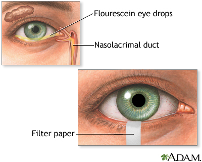 Schirmer's test