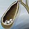 Gallstones