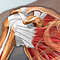Rotator cuff problems