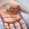 Carpal tunnel syndrome