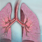 Chronic obstructive pulmonary disease