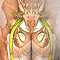 Sciatica
