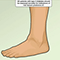 Type 2 Diabetes foot and leg care