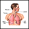 Lung transplant - series