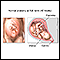 Vaginal birth - series - normal anatomy