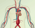 Aortic aneurysm description