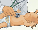 Congenital heart defects (CHD) overview