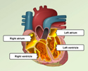 Cardiac conduction system disorders - overview