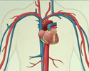 Cardiovascular disease - description