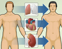 Heart transplant - overview