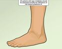Type 2 Diabetes foot and leg care