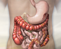 Ulcerative colitis